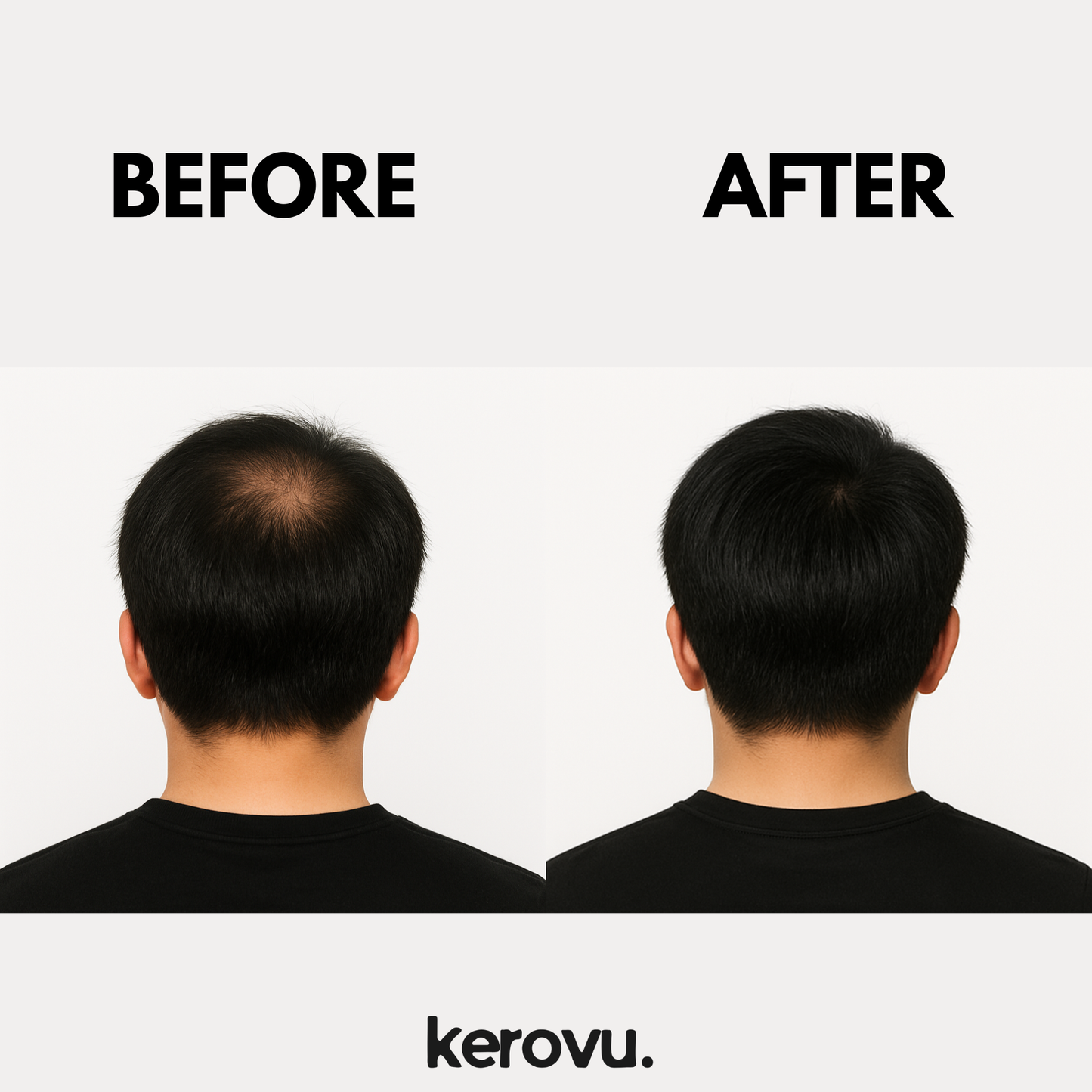 Kerovu Hair Building Fibers
